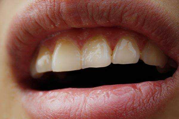 性身体几个重要部位,可能会从什么年纪开始衰老? 性身体几个重要部位,可能会从什么年纪开始衰老?