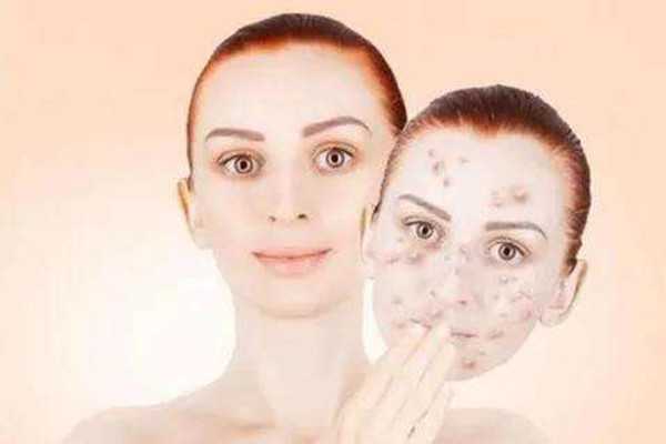 黄瓜和白可以去除黄褐斑吗