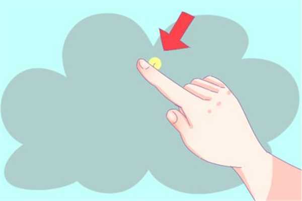 倒刺会自己掉吗 倒刺不处理会怎么样