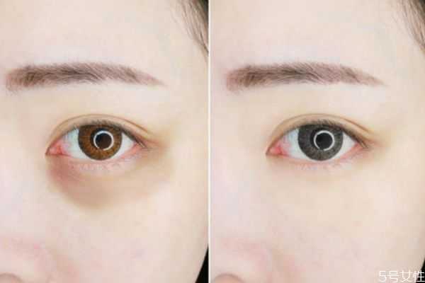 维生素e加凡士林可以去眼纹吗?维生素e加凡士林要洗吗