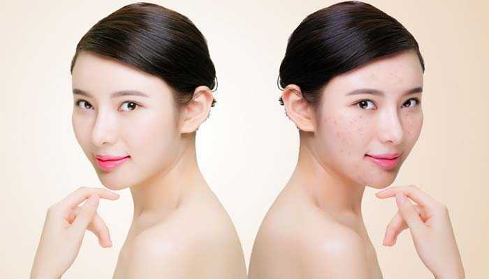 去角质的有什么好处 去角质多久用一次比较好