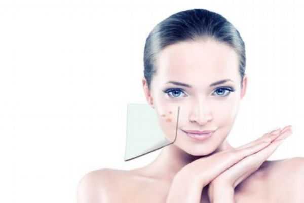 额头长痘痘的原因有哪些