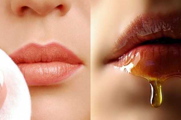 嘴唇死皮太多怎么办