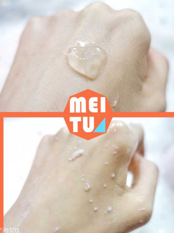 去鸡皮肤用什么好