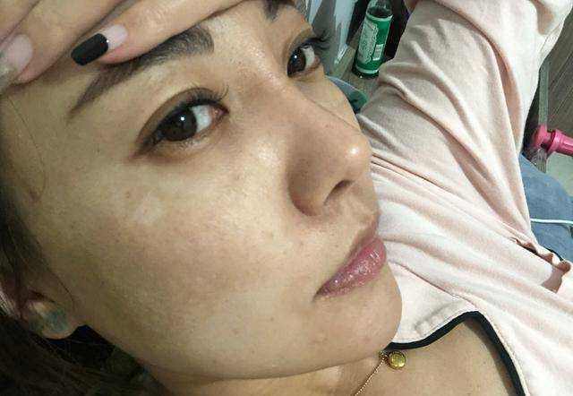 长期服用逍遥丸，真的能淡化黄褐斑吗