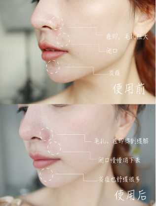 科颜氏白泥面膜怎么样