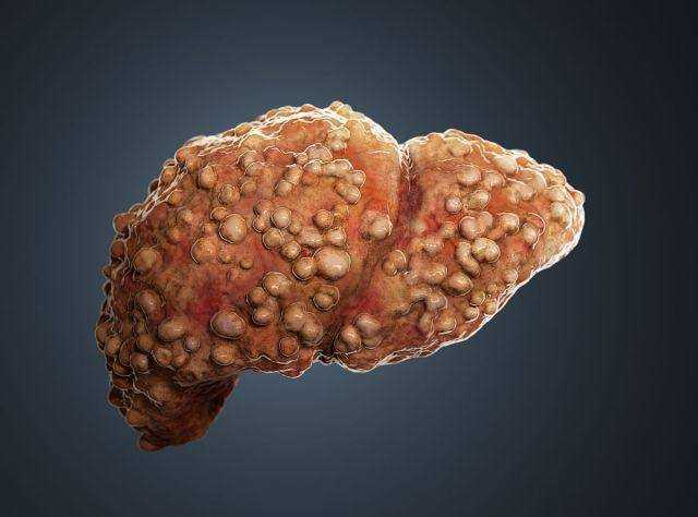 不利于肝脏的食物有哪些？