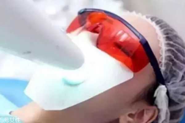 美牙仪伤牙齿吗 美牙仪伤牙齿吗