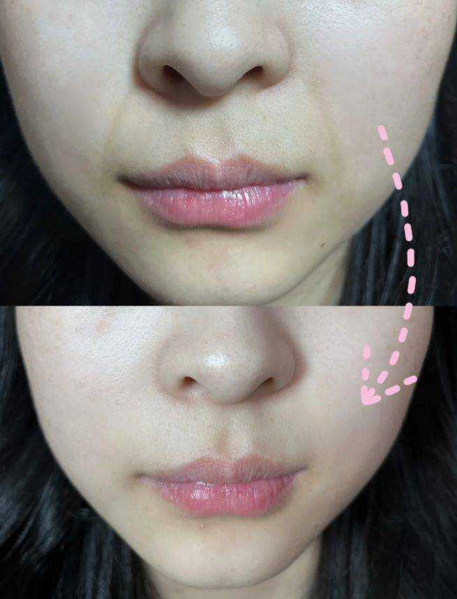 怎样去除皱纹：掌握这4种方法真不容易变老！ 