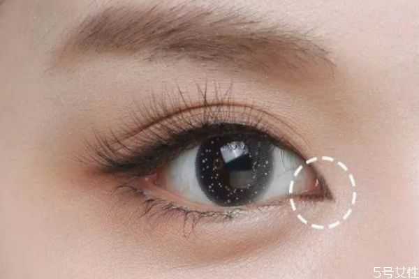 眼距宽怎么改善？怎样改善眼距过宽