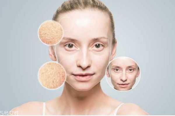 皮肤干燥起皱纹怎么办