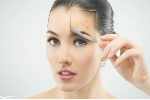 疤克用手擦还是用棉签 疤克用手擦还是用棉签