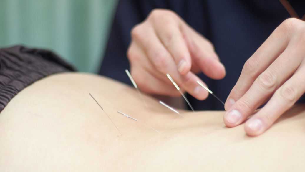 想学针灸推拿普通人去哪里学 想学针灸推拿普通人去哪里学