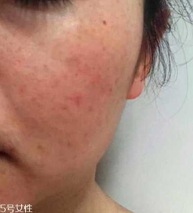 海本修护冻干粉怎么样 海本修护冻干粉怎么样