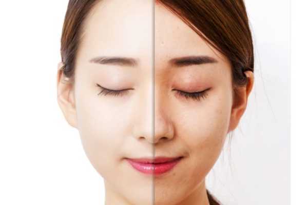 皮肤暗黄用什么牌子护肤品效果好