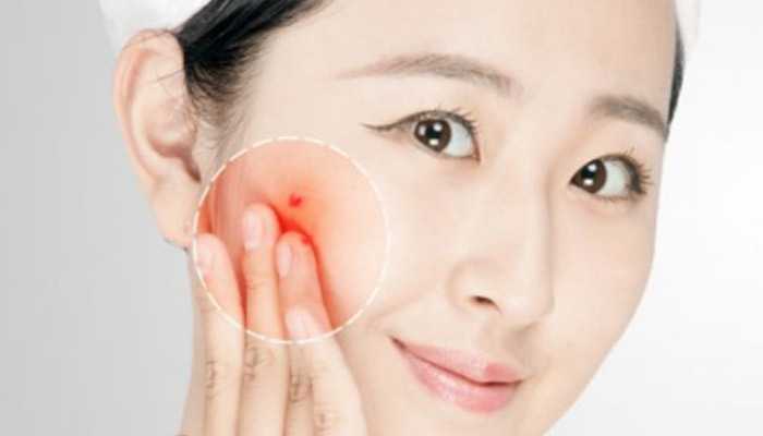 bb霜需要卸妆吗 bb霜需要卸妆吗