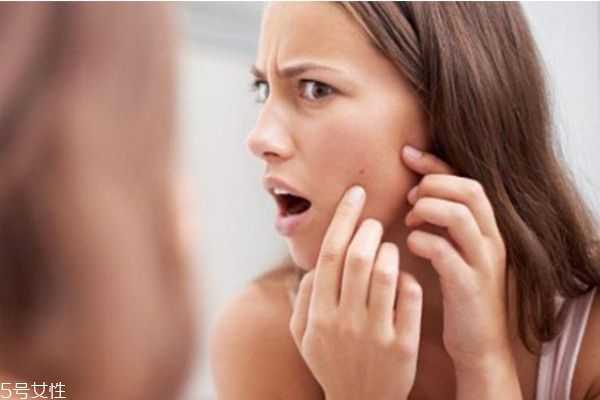 干皮为什么还长痘