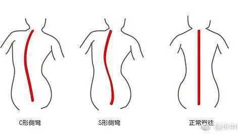 日式整骨都可以做哪些项目