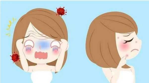脸部冒痘该怎么办？