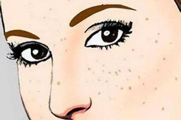 黄褐斑敷面膜有用吗