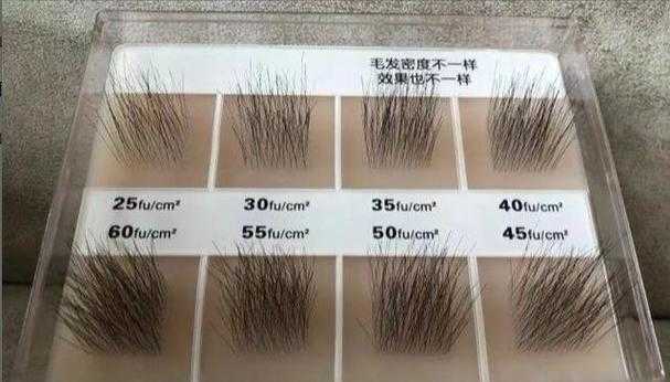 植发要多少钱一般 植发要多少钱一般