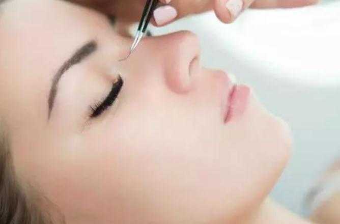 种睫毛眼皮过敏红肿痒怎么办 种睫毛眼皮肿了几天能好