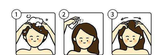 头发经常爱出油，还有头皮屑该怎么办？