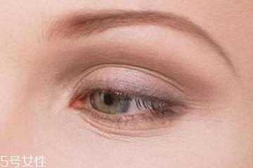 眼角细纹是什么原因