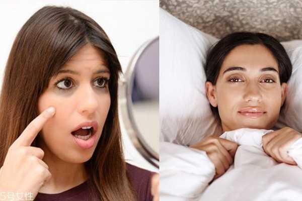 黑眼圈有几种颜色