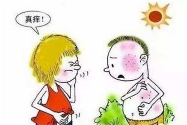 晒伤的表现是怎样的?晒伤有什么好办法补救