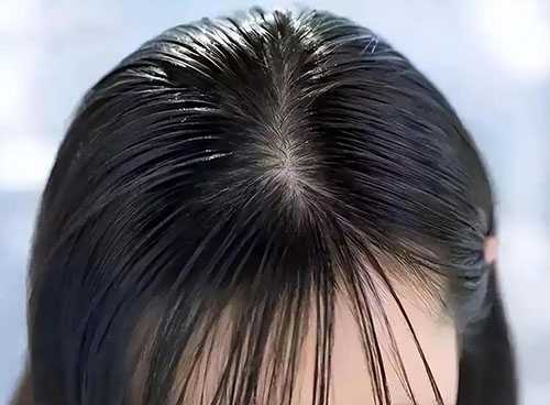 发胶会导致白发吗