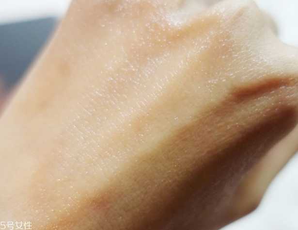 去鸡皮肤用什么好