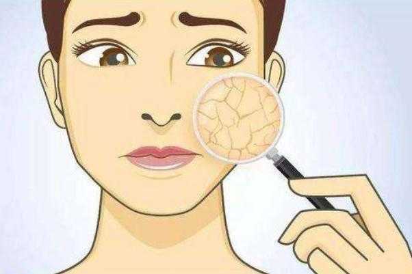 皮肤干燥脱皮严重像鱼鳞怎么办