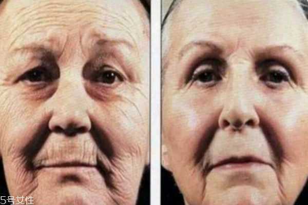 每天坚持用防晒的变化