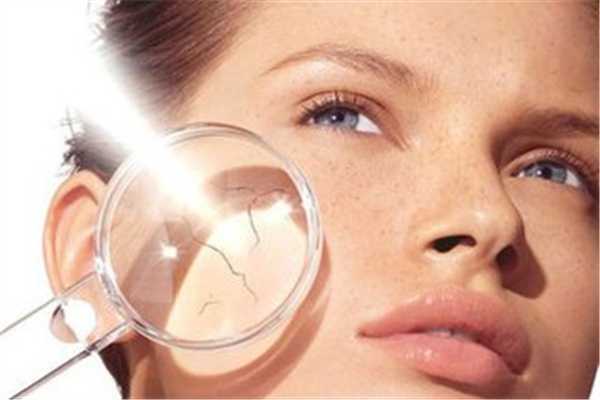 晒后用芦荟胶修复有用吗 晒后用什么修复比较好