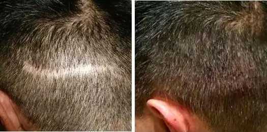 纹发这个行业怎么样?有前景吗? 纹发这个行业怎么样?有前景吗?