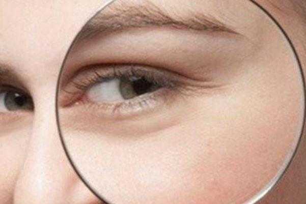 鱼尾纹要怎样淡化 鱼尾纹要怎么食补