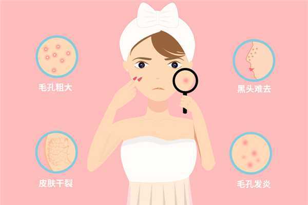 黑头要定期清理吗?黑头多久清理一次比较好 黑头要定期清理吗?黑头多久清理一次比较好