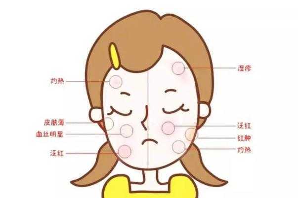 皮肤晒伤有什么办法?自己会恢复吗 皮肤晒伤有什么办法?自己会恢复吗