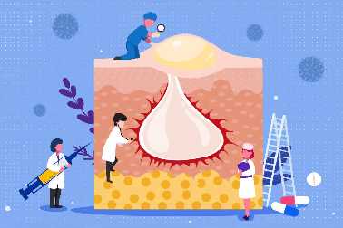 痘印痘坑难消除？这个方法强烈建议你试试