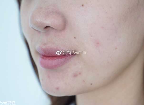 悦诗风吟小白管怎么用 悦诗风吟小白管怎么用