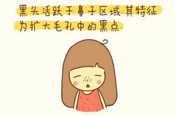 去完黑头后用什么收缩毛孔?黑头去完后要用什么东西护理 去完黑头后用什么收缩毛孔?黑头去完后要用什么东西护理