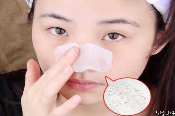 怎样正确的去黑头？正确清理鼻子上的黑头方法