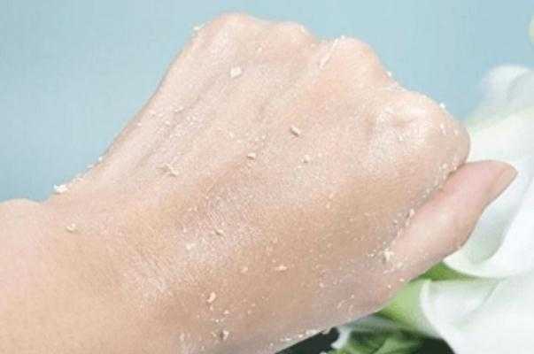 什么人需要去角质 什么人需要去角质