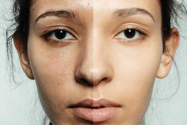 皮肤暗黄怎么变白最快的方法 皮肤暗黄怎么变白最快的方法