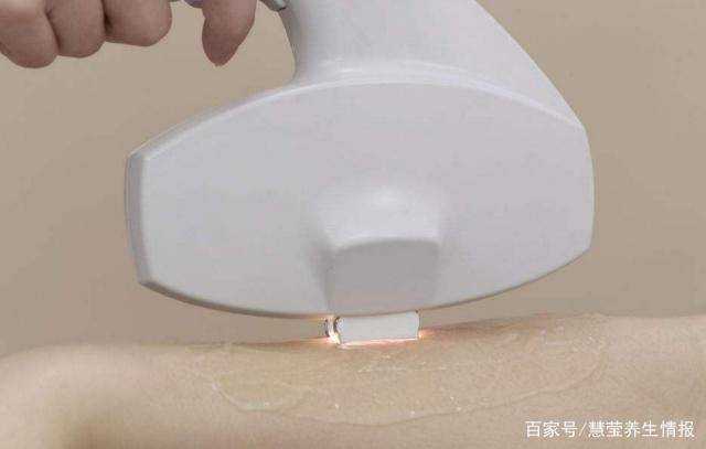 为什么有些女生汗毛多过男人？通常是3个原因导致的，不妨了解下 