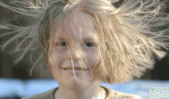 头发静电大是咋回事?头发有静电怎么去除 头发静电大是咋回事?头发有静电怎么去除