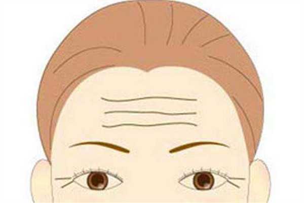怎样去掉抬头纹 去掉抬头纹的方法