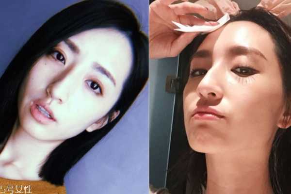 敏感肌怎样保养