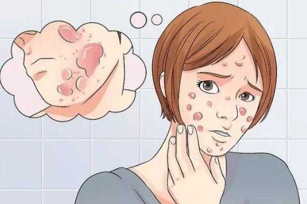 青春痘对身体有什么危害 青春痘对身体有什么危害